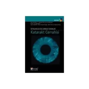 Oftalmolojide Cerrahi Teknikleri Katarakt Cerrahis
