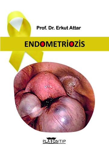 ENDOMETRİOZİS